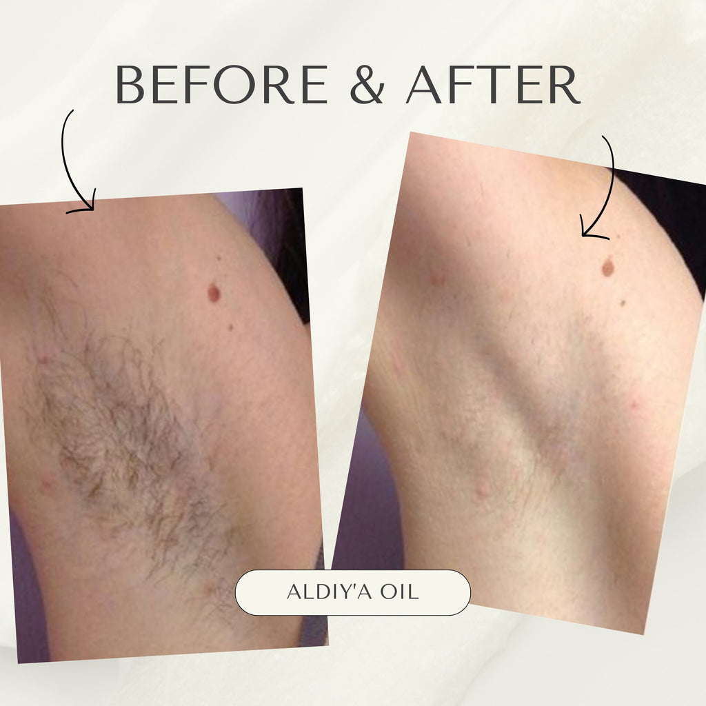 Aldiy'a Hair Reduction Oil